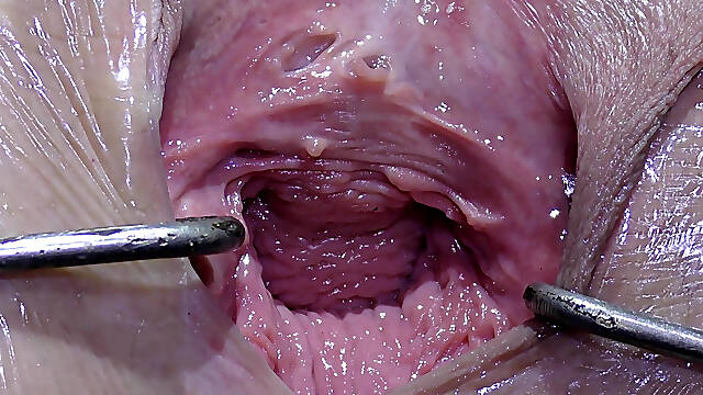 Wide Open